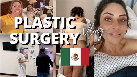 Tummy Tuck in Tijuana, Mexico